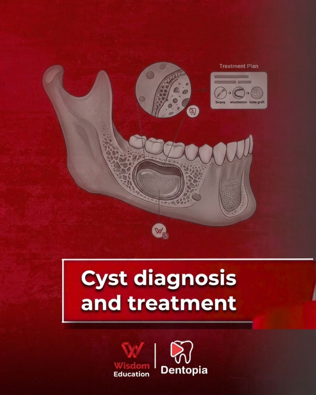 Endodontics Essentials Bundle