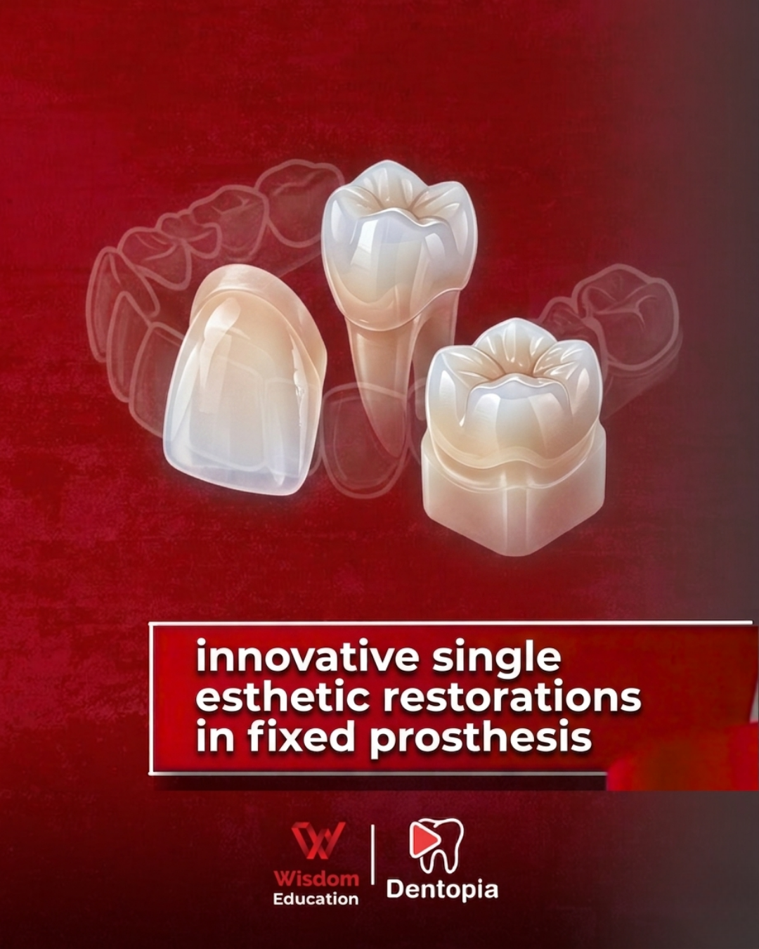 Prosthodontics Hands-on Workshop