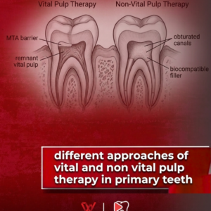 different approaches of vital and non vital pulp therapy in primary teeth