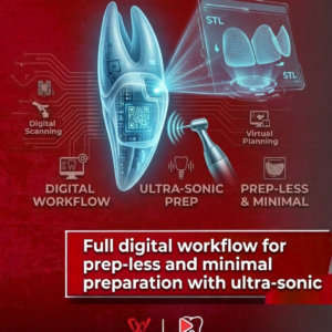 full digital workflow for prep-less and minimal preparation with ultra-sonic